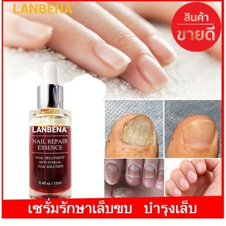 ของแท้ 100% LANBENA เซรั่มบำรุงเล็บ น้ำยาบำรุงเล็บ 15ml บำรุงเล็บ ต่อต้านการติตเชื้อรา ซ่อมแซมเล็บแตก เล็บเปราะ เล็บหนา