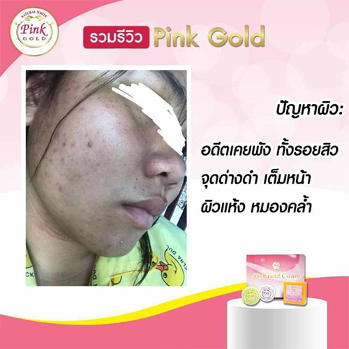 [เก็บโค้ด ได้ส่วนลดเพิ่ม] Pink Gold Cream ครีมหน้าใส ครีมบำรุงผิวหน้า กู้หน้าพัง Set ใหญ่ - รูปที่ 6