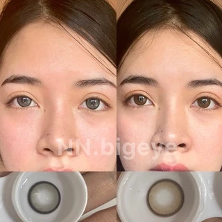 คอนแทคเลนส์ Luxzy lens ( love too ) ขนาดกลาง 14.2