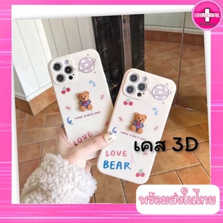 เคสน่ารัก เคส 3D คลุมกล้อง
