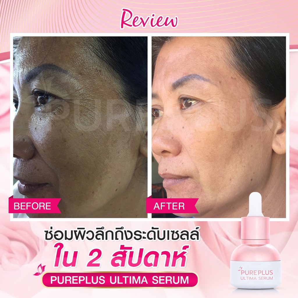 à¸‹à¸·à¹‰à¸­ 1à¹ à¸–à¸¡2???? à¸ªà¹ˆà¸‡à¸Ÿà¸£à¸µâ€¼ï¸ Pureplus à¸­à¸±à