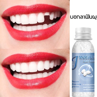 ยอดขายอันดับ1 Moldable ซ่อมฟันชั่วคราว กาวซ่อมแซมฟันชั่วคราวแบบปรับได้