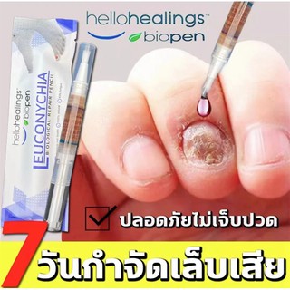 Hellohealings เซรั่มรักษาเล็บ เล็บพัง เล็บขบ เซรั่มบำรุงเล็บ น้ำมันบำรุงเล็บ ดูแลเล็บ ครีมบำรุงซ่อมแซมเล็บ