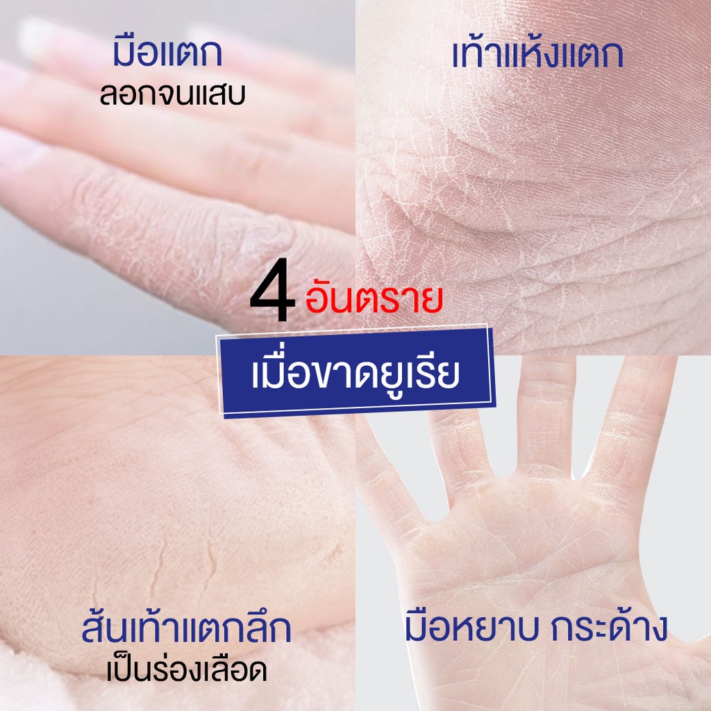 ครีมทามือ ส้นเท้าแตก จากญี่ปุ่น ฟาริส 9% ยูเรีย Faris 9% Urea & Shiso Hand and Foot Advanced Repair Cream 50 g. - รูปที่ 4