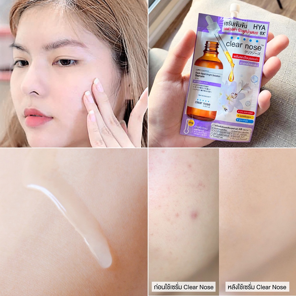 Clear Nose Dark Spot Bright Solution Serum 100ml.  เคลียร์โนส ดาร์ค สป็อต ผิวแลดูกระจ่างใส สม่ำเสมอ จุดด่างดำแลดูลดเลือน