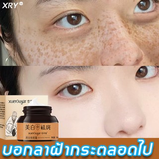 XRY ครีมทาฝ้าลึก 30g ละลายคราบจุดด่างดำ ผิวขาวสดใสเห็นได้ชัด ครีมทาฝ้ากระ ครีมทาฝ้ากะ ครีมไวท์เทนนิ่งฝ้า ครีมหน้าขาวใส