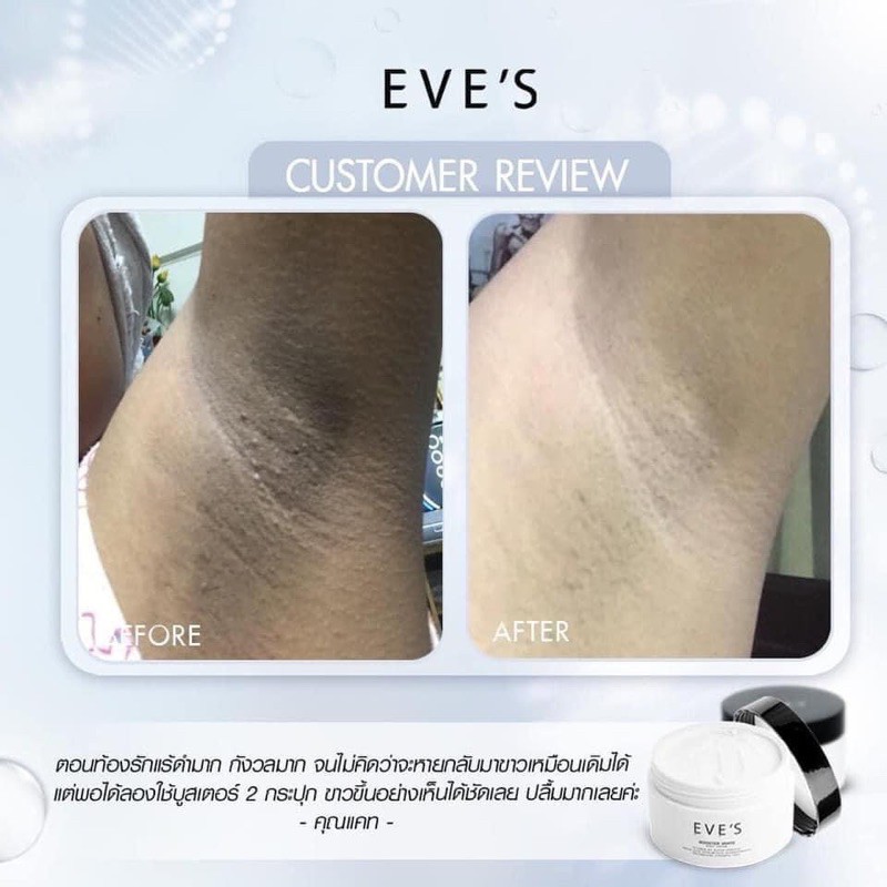 ครีมรักแร้ขาว EVE’S Booster