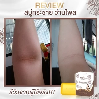 สบู่กระชายว่านไพล กำจัดติ่งเนื้อ ฝ้ากระ คอดำ ใบหน้าคล้ำ แก้ปัญหา กลาก เกลื้อน เชื้อรา สะเก็ดเงิน สิวที่หน้า สิวที่หลัง