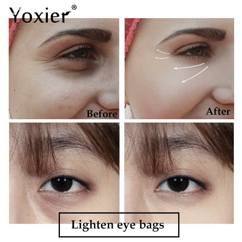yoxier eye cream