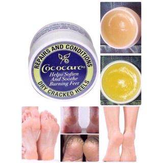 ส่งฟรีทั่วไทย !!! Cococare, Repairs and Conditions Dry Cracked Heels 11g ครีมทาส้นเท้าแตก เห็นผลในกระปุกแรก