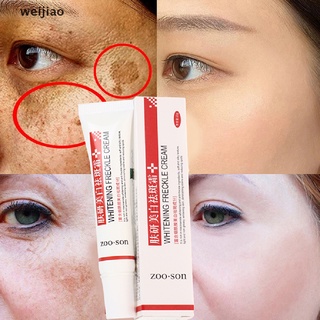 wei Freckle Cream Remove Skin Melasma Acne Spot Pigment Melanin Dark Spots Whitening ie