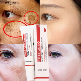 wei Freckle Cream Remove Skin Melasma Acne Spot Pigment Melanin Dark Spots Whitening ie