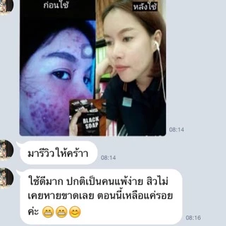 ส่งไว สบู่ถ่าน ชาร์โคล ผสมกลูต้า​คอลลาเจน​ 🚀ส่งด่วน2ชม กรุงเทพ ปริมณฑล ⚫