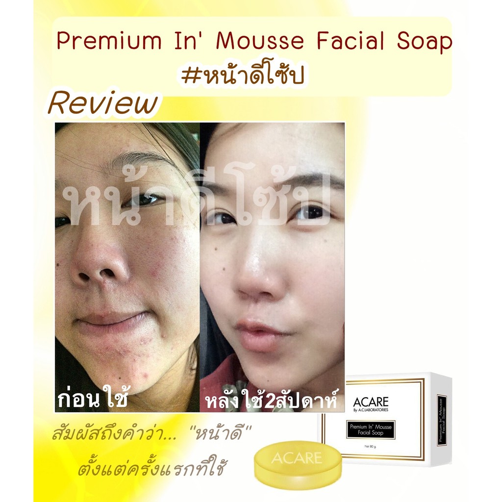 D-Soap สบู่หน้าดีโซ้ป สบู่ลดสิว กระชับรูขุมขน รูปที่ 3