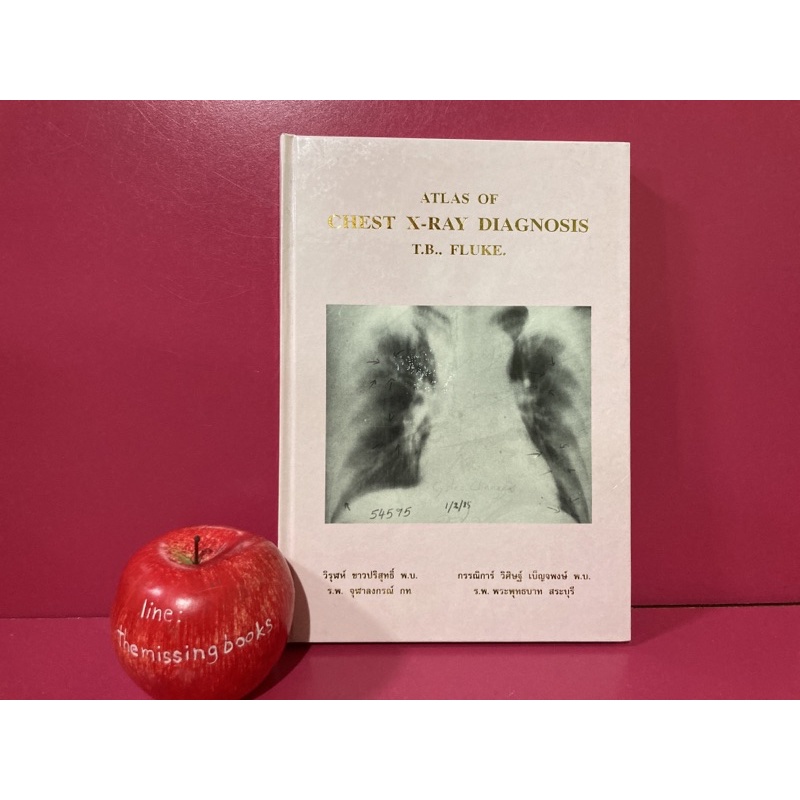 ATLAS OF CHEST X-RAY DIAGNOSIS T.B., FLUKE. การวินิจฉัย วัณโรคปอด และ พยาธิใบไม้ปอด หนังสือการแพทย์ 