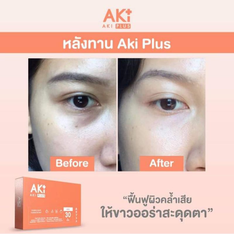 (ส่งฟรี) Aki plus แท้ วิตามินผิวเกรดพรีเมี่ยม ขาวใส ไร้สิวฝ้า สวยหน้าสด ...