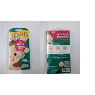 แพ็คใหม่ แผ่นแปะสิว SOS ACNE PATCH 12 ชิ้น กล่องเขียว (EXP 07/2025)