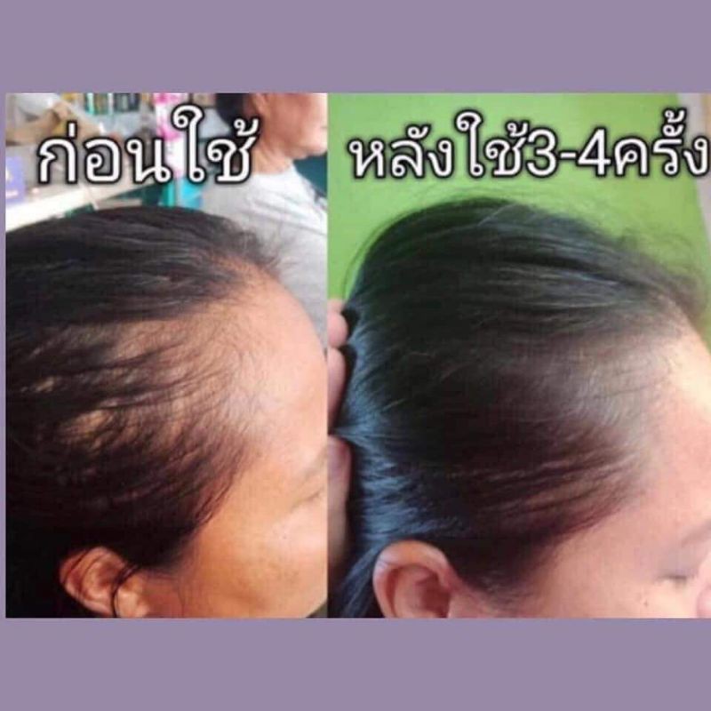 เข้มทุกหยด legano hair tonic​ 120มล. การันตี​เห็นผล ​เร่ง​ผม​ยาว​เร็ว​ ไม่​ขาด​หลุด​ร่วง​ปลูกผมใหม่
