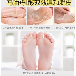 Horse oil Foot Care ถุงผลัดผิวหนังเท้า