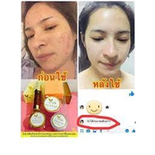 ครีมมาเชอร์รี่ MACHE'RE BY JUMI Whitening Cream Set (Gold Box Set)