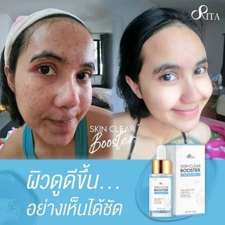 เซรั่มริต้า RITA Skin Clear Booster Serum 20g.