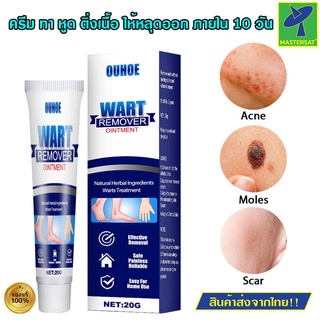 OUHOE Wart Remover Ointment ครีม ทาหูด ทาติ่งเนื้อ ให้หลุดออก ครีมสมุนไพร ใช้งานง่าย ช่วยให้ผิวกลับเรียบเนียน ดังเดิม ขน