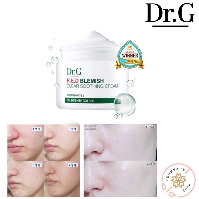 (แท้/พร้อมส่ง/อ่านรายละเอียดก่อนสั่ง) DR.G RED BLEMISH CLEAR SOOTHING CREAM 70 ML อันดับ1 โอลีฟยัง2020