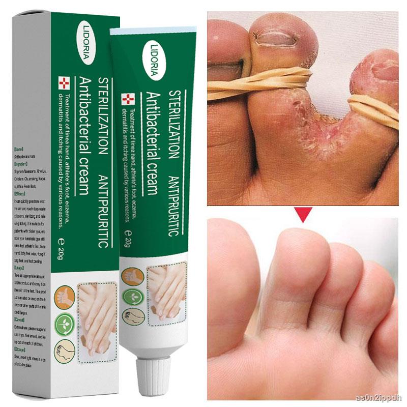 Herbal Foot Treatment Nail Fungus Removal Anti Fungal Infection