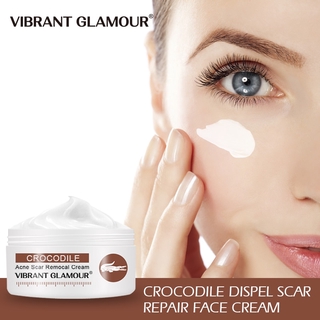 cream to remove acne scars on face