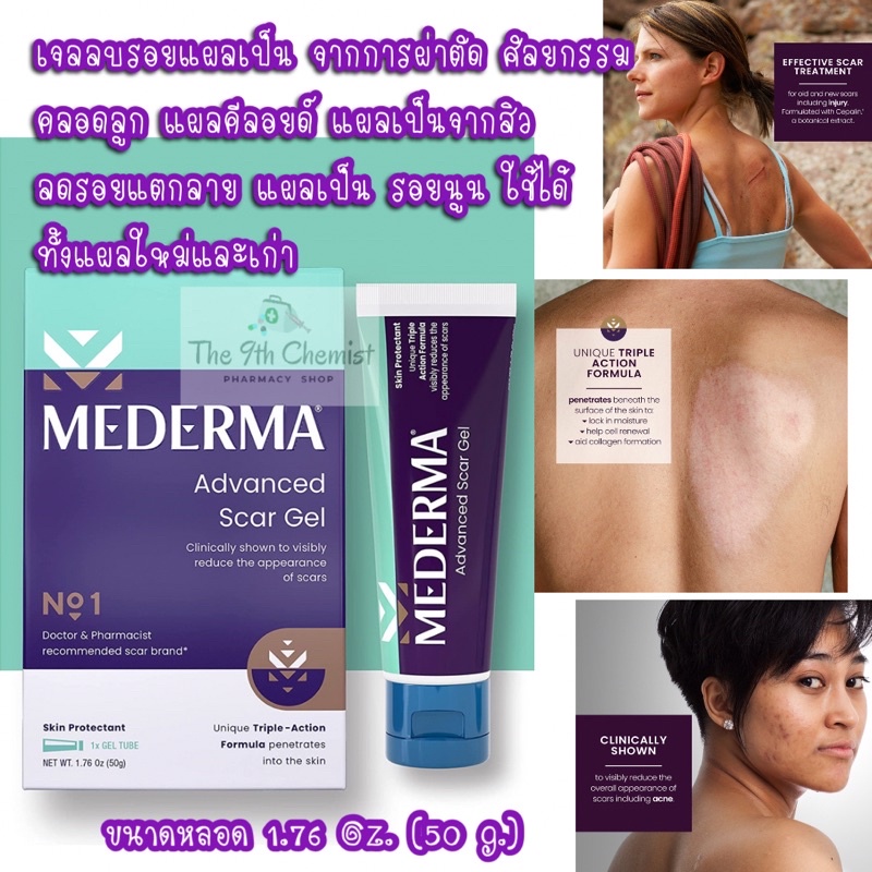 Mederma, Advanced Scar Gel, 1.76 oz (50 g) เจลใสลบลอยแผลเป็นทั้งแผลเก่าและใหม่ แบรนด์อันดับ 1 ที่แพท