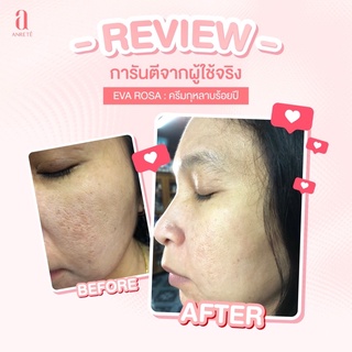 🚗ส่งฟรี 1 คืนเห็นผลทันที หน้าฟู รู้ขุมขนกระชับ ครีมกุหลาบ 100 ปี plant active cell anrete ฝ้า กระ จุดด่างดำ ริ้วรอย