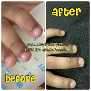Barielle No Bite Pro Growth ยาทาเล็บแก้เด็กกัดเล็บและดูดนิ้ว ของแท้จากUSA