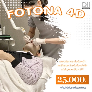 Dii Aesthetic : Fotona 4D 1Time เลเซอร์ยกกระชับ