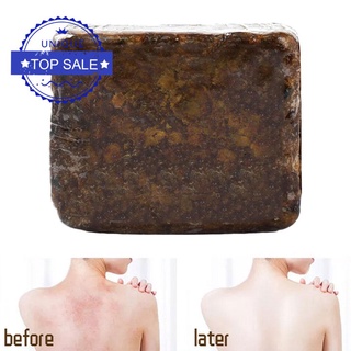 110g African Black Soap Body Cleansing Bath Soap Skin Beauty E3V5