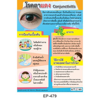 INTOP By OST Plastic Poster Conjunctivitis โรคตาแดง : 50x70 Cm #EP-479