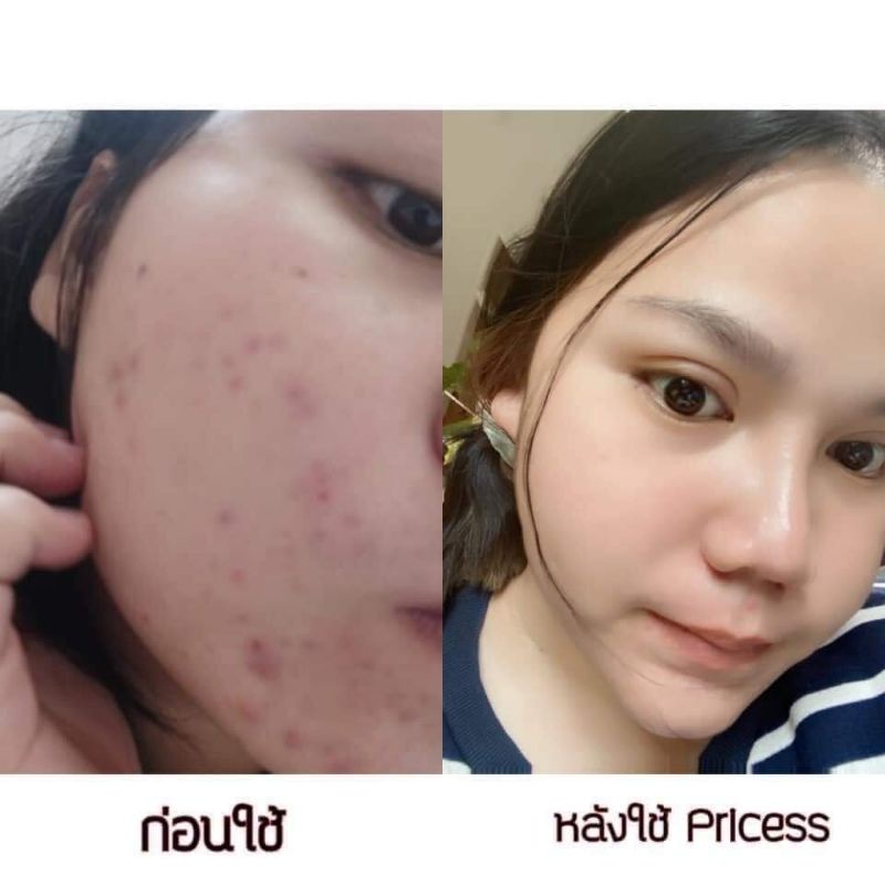 ครีมขมิ้นPrincess สมุนไพร