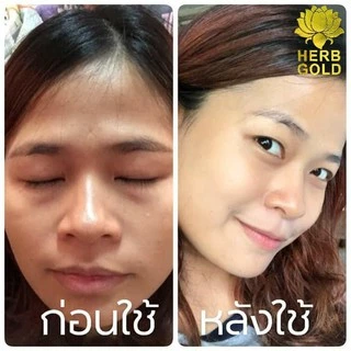 HERB Gold ครีมเฮิร์บ โกลด์ ชุด ครีม 30กรัม+ สบู่ 50 กรัม