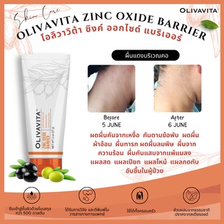 พร้อมส่ง โอลิวาวิต้าฝาส้ม (Olivavita) สูตรธรรมชาติลดผดผื่นคันจากเหงื่อและความร้อน แพ้แมลง แผลแสบไหม้และแผลกดทับ