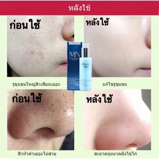💗ภายใน7วัน รูขุมขนกระชับขึ้น รูขุมขนกระชับ เซรั่มหน้าใส น้ำตบกระชับรูขุมขน น้ำตบ เซรั่มหน้าใส บำรุงผิวหน้า ไวท์เทนนิ่ง เ