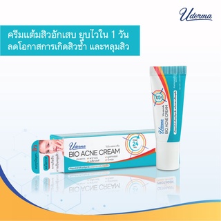 Uderma Bio Acne Cream (ยูเดอร์มา ไบโอ แอคเน่ ครีม)จบทุกปัญหาสิว