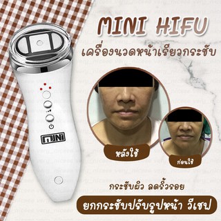 MINI HIFU เครื่องไฮฟูยกกระชับผิวหน้า ปรับรูปหน้า ทำหน้าวีเชฟ สร้างกรอบหน้า ทำหน้าเรียว ลดความหย่อนคล้อย