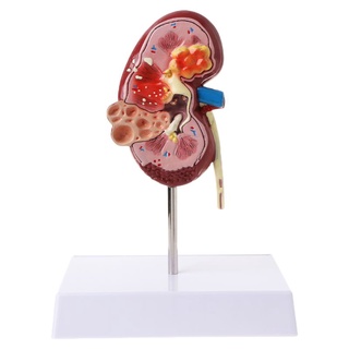 Uu Life Size Human Kidney โมเดลหินอนาโตมี่สําหรับใช้ในการเรียนรู้