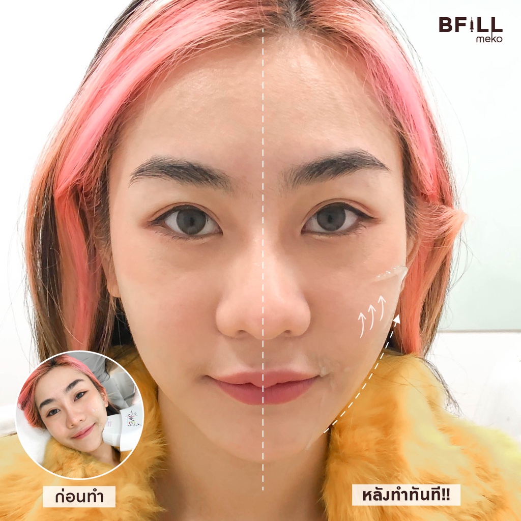 Premium Hifu By Doctor พรีเมียม ไฮฟู่ ทำโดยคุณหมอ