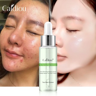 Caidiou  whitening drone acne serum เซรั่มสำหรับคนเป็นสิวพร้อมลดรอย 15ml