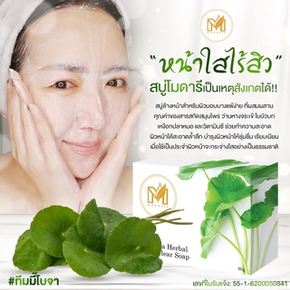 สบู่รักษาสิว ลดสิว ผดผื่น ผิวแพ้ง่าย ผิวแห้ง ผิวมัน ใช้ได้