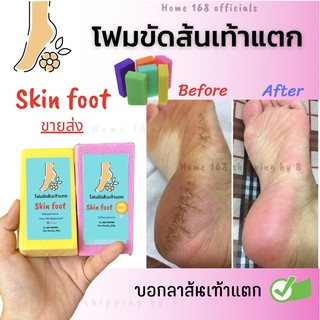 โฟมขัดส้นเท้า ขัดส้นเท้า Skin foot🦶 100%🦶เห็นผลตั้งแต่ครั้งแรกที่ใช้