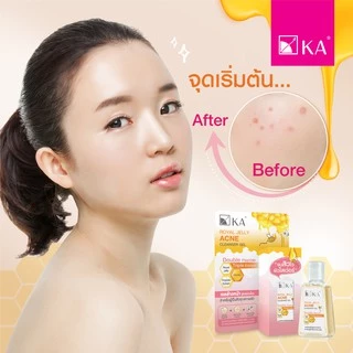 KA Royal Jelly Acne Cleanser Gel /เคเอ รอยัล เจลลี่ แอคเน่ คลีนเซอร์ เจล 30 กรัม เจลล้างหน้าสูตรอ่อนโยน
