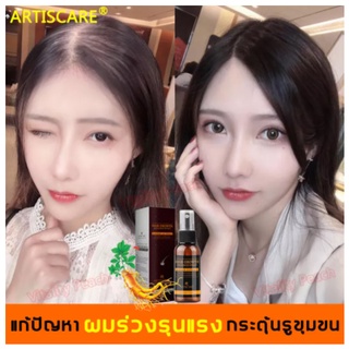 ไม่กังวลกับผมร่วง ARTISCARE เซรั่มปลูกผม เอสเซ้นบำรุงผม 30g ยาปลูกผมของแท้ เร่งการเจริญเติบโตของเส้นผมกระตุ้นถุงขน