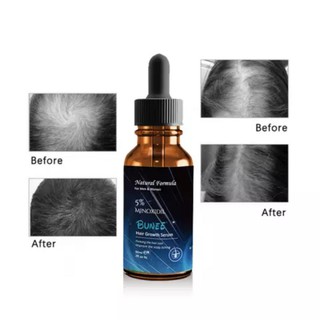 เซรั่มไบโอตินเข้มข้นปลูกผมปกป้องผมร่วง60ml.สำหรับผมบางหัวล้าน