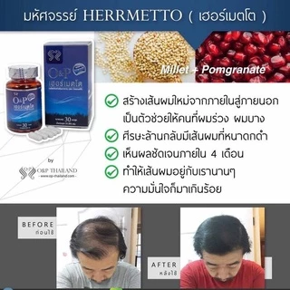 HERRMETTO[ของแท้100%] ฮอร์เมตโต ผลิตภัณฑ์เสริมอาหารวิตามินบำรุงเส้นผม สำหรับผู้ชาย